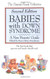 Babies With Down Syndrome: A New Parent's Guide