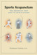 Sports Acupuncture: The Meridian Test and Its Applications