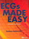 Ecg's Made Easy