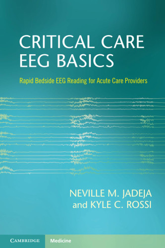 Critical Care EEG Basics