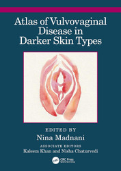 Atlas of Vulvovaginal Disease in Darker Skin Types