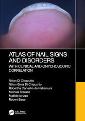 Atlas of Nail Signs and Disorders with Clinical and Onychoscopic