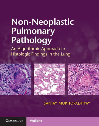 Non-Neoplastic Pulmonary Pathology with Online Resource