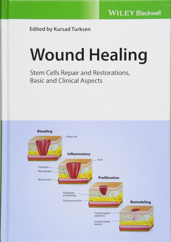 Wound Healing: Stem Cells Repair and Restorations Basic and Clinical