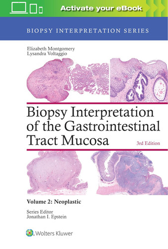 Biopsy Interpretation of the Gastrointestinal Tract Mucosa: Volume 2: