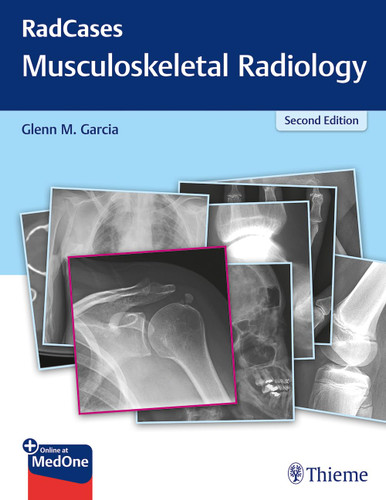 RadCases Q&A Musculoskeletal Radiology (Radcases Plus Q&A)
