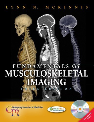 Fundamentals Of Musculoskeletal Imaging