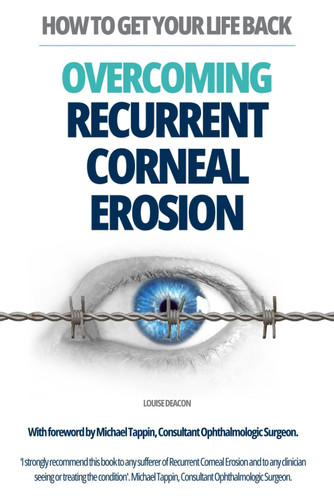 Overcoming Recurrent Corneal Erosion: How to Get Your Life Back