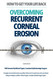 Overcoming Recurrent Corneal Erosion: How to Get Your Life Back