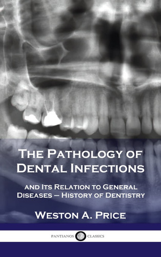 Pathology of Dental Infections: and Its Relation to General Diseases