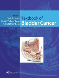 Textbook of Bladder Cancer