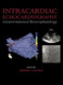 Intracardiac Echocardiography in Interventional Electrophysiology