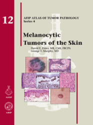 Melanocytic Tumors of the Skin
