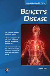 Behcet's Disease (MyModernHealth FAQs)