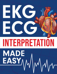 ECG Interpretation Made Easy: An Illustrated Study Guide