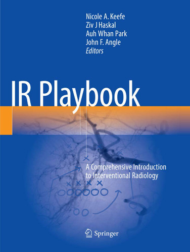 IR Playbook