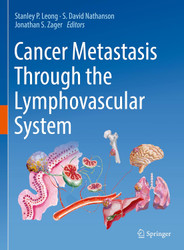 Cancer Metastasis Through the Lymphovascular System: A Comprehensive