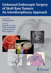 Endonasal Endoscopic Surgery of Skull Base Tumors: An