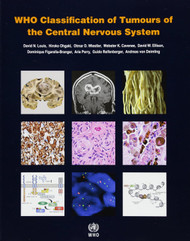 WHO Classification of Tumours of the Central Nervous System [OP]