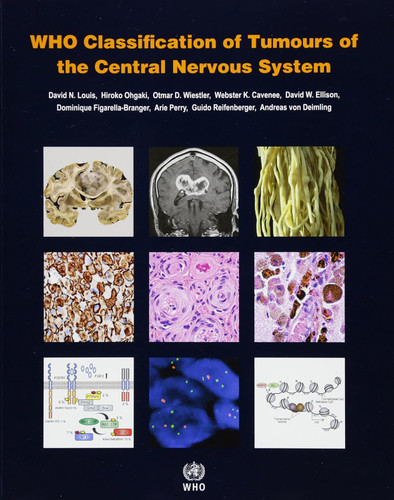 WHO Classification of Tumours of the Central Nervous System [OP]