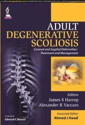 Adult Degenerative Scoliosis: Coronal and Sagittal Deformities: