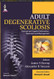 Adult Degenerative Scoliosis: Coronal and Sagittal Deformities: