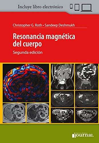 Resonancia Magnetica del Cuerpo (Spanish Version)