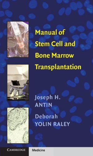 Manual Of Stem Cell And Bone Marrow Transplantation