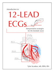 Introduction to 12-Lead ECGs: Interpretation Strategies for The