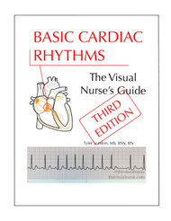Basic Cardiac Rhythms: The Visual Nurse's Guide