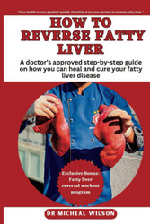 How to reverse fatty liver: A doctor's approved step-by-step guide on