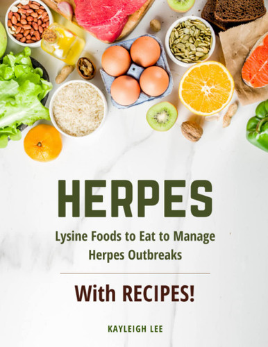 Herpes: Lysine Foods to Eat to Manage Herpes Outbreaks With Recipes!: