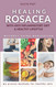 Healing Rosacea With Anti-inflammatory Diet And Healthy Lifestyle