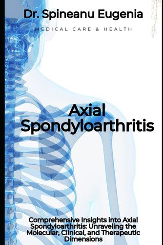 Comprehensive Insights into Axial Spondyloarthritis