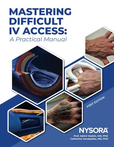 Mastering Difficult IV Access - a Practical Manual: