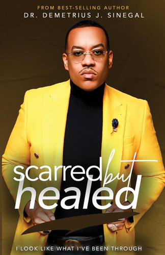 Scarred But Healed: I look like what I've been through