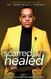 Scarred But Healed: I look like what I've been through