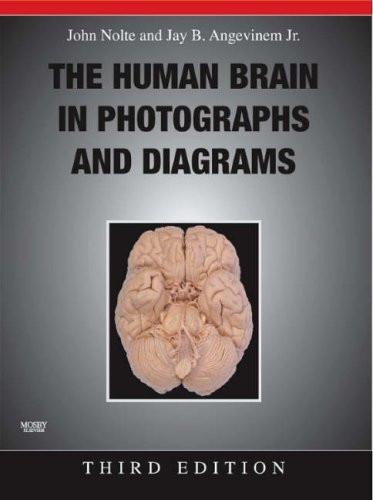 Human Brain In Photographs And Diagrams