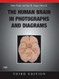 Human Brain In Photographs And Diagrams