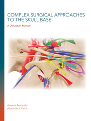 Complex Surgical Approaches to the Skull Base
