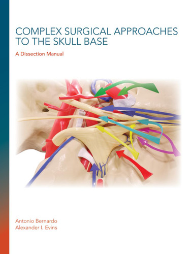 Complex Surgical Approaches to the Skull Base