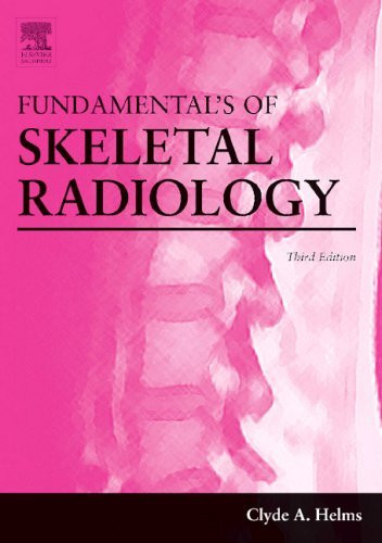 Fundamentals Of Skeletal Radiology