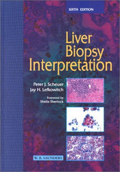 Liver Biopsy Interpretation