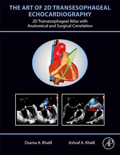The Art of 2D Transesophageal Echocardiography: 2D Transesophageal