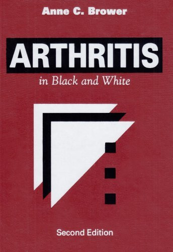 Arthritis