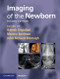 Imaging of the Newborn (Cambridge Medicine (Hardcover)