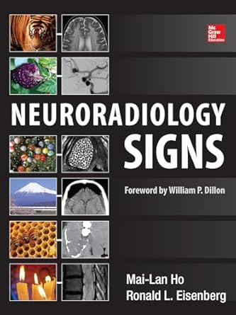 Neuroradiology Signs