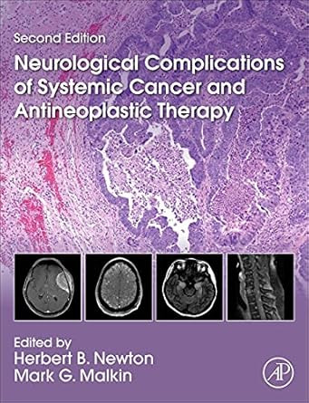 Neurological Complications of Systemic Cancer and