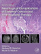 Neurological Complications of Systemic Cancer and