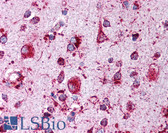 Anti-LIMPII / SCARB2 Antibody (C-Terminus) IHC-plus LS-B305